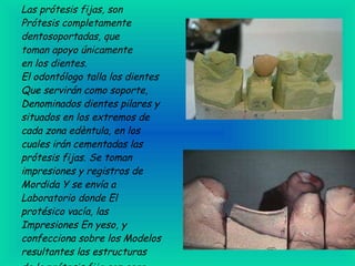 Las prótesis fijas, son Prótesis completamente dentosoportadas, que toman apoyo únicamente en los dientes.   El odontólogo talla los dientes Que servirán como soporte, Denominados dientes pilares y situados en los extremos de cada zona edèntula, en los cuales irán cementadas las prótesis fijas. Se toman impresiones y registros de Mordida Y se envía a Laboratorio donde El protésico vacía, las Impresiones En yeso, y confecciona sobre los Modelos resultantes las estructuras  de la prótesis fija con cera.                                      