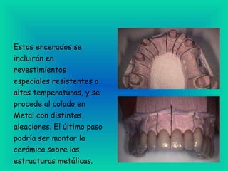 Estos encerados se incluirán en revestimientos especiales resistentes a altas temperaturas, y se procede al colado en Metal con distintas aleaciones. El último paso podría ser montar la cerámica sobre las estructuras metálicas.                                                                                                                                           