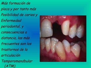 Más formación de placa y por tanto más Posibilidad de caries y Enfermedad periodontal, y consecuencias a distancia, las más frecuentes son los trastornos de la articulación  Temporomandbular (ATM).                                                                                 