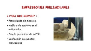 IMPRESIONES PRELIMINARES
¿ PARA QUE SIRVEN? :
• Paralelizado de modelos.
• Análisis de modelos en el
articulador.
• Diseño preliminar de la PPR.
• Confección de cubetas
individuales.
 