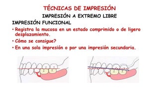 TÉCNICAS DE IMPRESIÓN
IMPRESIÓN A EXTREMO LIBRE
IMPRESIÓN FUNCIONAL
• Registra la mucosa en un estado comprimido o de ligero
desplazamiento.
• Cómo se consigue?
• En una sola impresión o por una impresión secundaria.
 