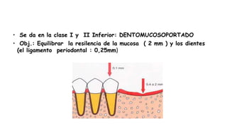 • Se da en la clase I y II Inferior: DENTOMUCOSOPORTADO
• Obj.: Equilibrar la resilencia de la mucosa ( 2 mm ) y los dientes
(el ligamento periodontal : 0,25mm)mm ) .
 