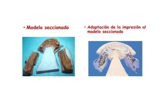 • Modelo seccionado • Adaptación de la impresión al
modelo seccionado
 