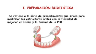 I. PREPARACIÓN BIOSTÁTICA
Se refiere a la serie de procedimientos que sirven para
modificar las estructuras orales con la finalidad de
mejorar el diseño y la función de la PPR
 