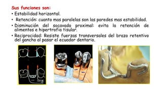 Sus funciones son:
• Estabilidad horizontal.
• Retención: cuanto mas paralelas son las paredes mas estabilidad.
• Disminución del socavado proximal: evita la retención de
alimentos e hipertrofia tisular.
• Reciprocidad: Resiste fuerzas transversales del brazo retentivo
del gancho al pasar el ecuador dentario.
 