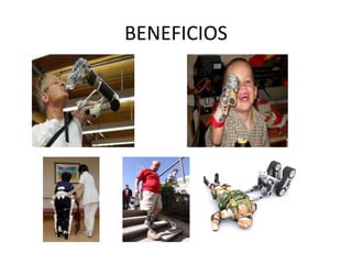 BENEFICIOS
 