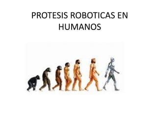 PROTESIS ROBOTICAS EN
HUMANOS
 