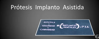 Prótesis Implanto Asistida
 