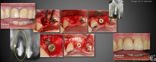 Cirugia Dr. R. Vilavedra




 Técn. J.C. Sebático
 