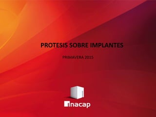 PRIMAVERA 2015
PROTESIS SOBRE IMPLANTES
 