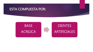 ESTA COMPUESTA POR:
BASE
ACRILICA
DIENTES
ARTIFICIALES