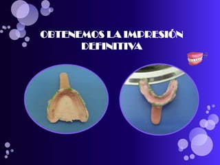 OBTENEMOS LA IMPRESIÓN
DEFINITIVA
 