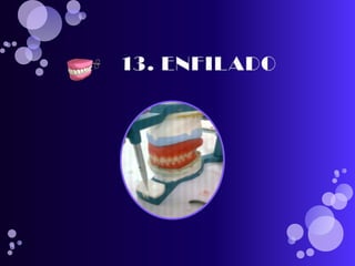 pasos para realizar una protesis total 