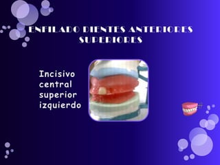 pasos para realizar una protesis total 