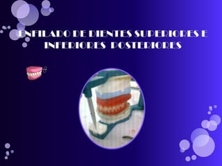 pasos para realizar una protesis total 