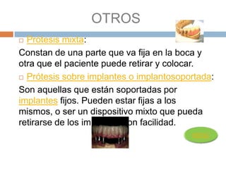 OTROS
 Prótesis mixta:
Constan de una parte que va fija en la boca y
otra que el paciente puede retirar y colocar.
 Prótesis sobre implantes o implantosoportada:

Son aquellas que están soportadas por
implantes fijos. Pueden estar fijas a los
mismos, o ser un dispositivo mixto que pueda
retirarse de los implantes con facilidad.
 