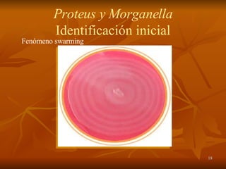 Fenómeno swarming Proteus y Morganella Identificación inicial 