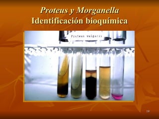 Proteus y Morganella Identificación bioquímica 