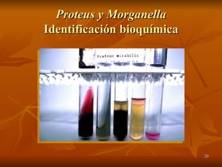 Proteus y Morganella Identificación bioquímica 