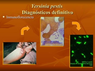 Yersinia pestis   Diagnósticos definitivo Inmunoflorecencia 