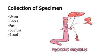 Collection of Specimen
• Urine
• Feces
• Pus
• Sputum
• Blood
 