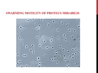 proteus mirabilis swarming motility