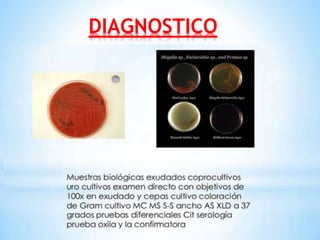 DIAGNOSTICO
 