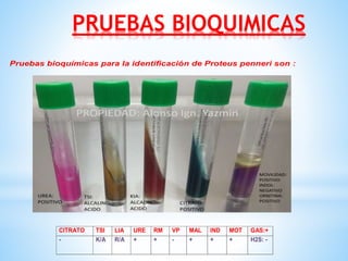 PRUEBAS BIOQUIMICAS
Pruebas bioquímicas para la identificación de Proteus penneri son :
CITRATO TSI LIA URE RM VP MAL IND MOT GAS:+
- K/A R/A + + - + + + H2S: -
 