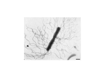 Comprehensive Overview of Proteus Species: Morphology, Biochemistry ...