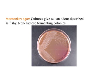 Macconkey agar: Cultures give out an odour described
as fishy, Non- lactose fermenting colonies .

 
