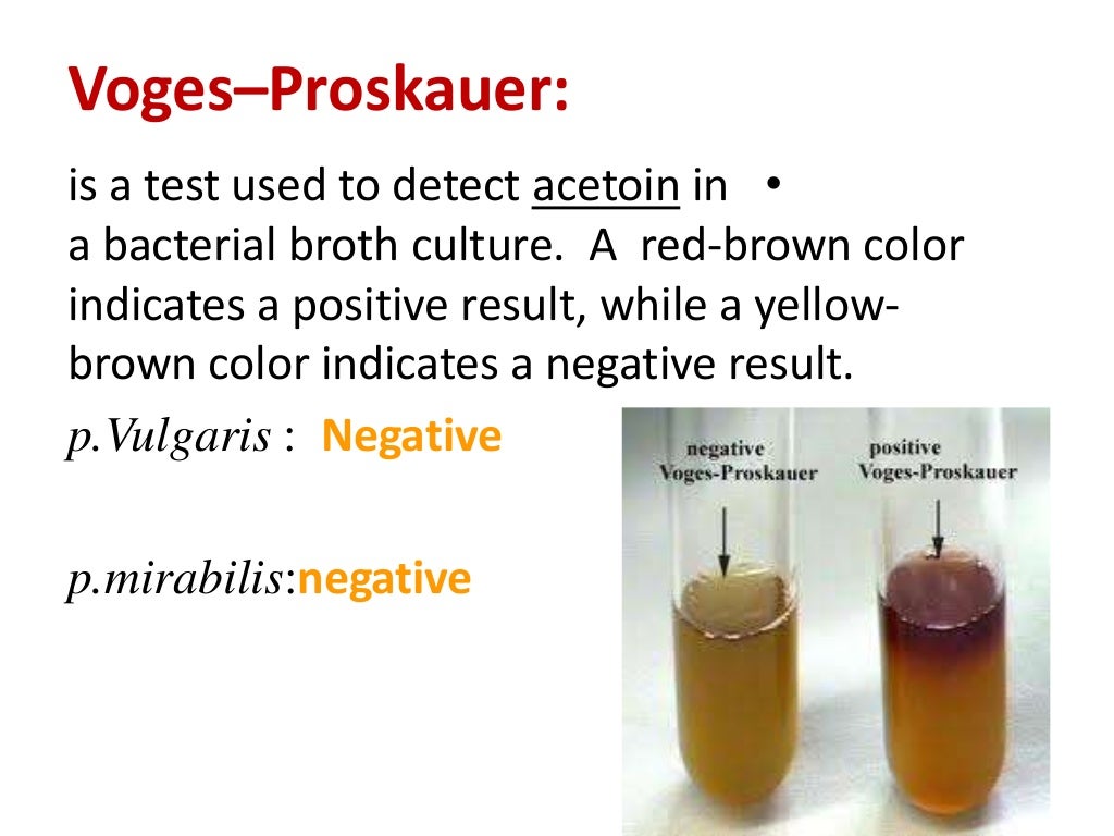 microbiology lab methyl red and voges proskauer microbiology lab methyl red and voges proskauer