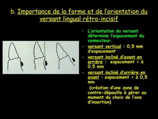 b. Importance de la forme et de l’orientation du
versant lingual rétro-incisif
• L’orientation du versant
détermine l’espacement du
connecteur.
- versant vertical : 0,5 mm
d’espacement
- versant incliné d’avant en
arrière : espacement > à
0,5 mm
- versant incliné d’arrière en
avant : espacement > à 0,5
mm
(création d’une zone de
contre-dépouille à gérer au
moment du choix de l’axe
d’insertion)
 