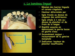 c. Le bandeau lingual
• Réunion des barres linguale
et corono-cingulaire.
• Hauteur déterminée par
- ligne tracée au dessus du
cingulum des antérieures
- ligne située à 1 mm au-
dessus du plancher et du
frein de la langue
 Rigidité assurée en
épaississant la partie basse
en goutte d’eau
 Inconvénient majeur :
recouvrement de la gencive
marginale
 Indication: hauteur de
plancher insuffisante
 