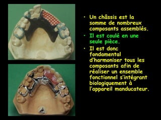 • Un châssis est la
somme de nombreux
composants assemblés.
• Il est coulé en une
seule pièce.
• Il est donc
fondamental
d’harmoniser tous les
composants afin de
réaliser un ensemble
fonctionnel s’intégrant
biologiquement à
l’appareil manducateur.
 