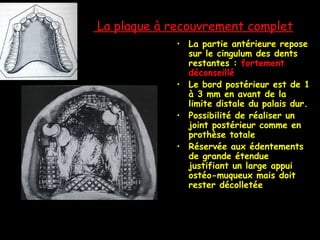 La plaque à recouvrement complet
• La partie antérieure repose
sur le cingulum des dents
restantes : fortement
déconseillé
• Le bord postérieur est de 1
à 3 mm en avant de la
limite distale du palais dur.
• Possibilité de réaliser un
joint postérieur comme en
prothèse totale
• Réservée aux édentements
de grande étendue
justifiant un large appui
ostéo-muqueux mais doit
rester décolletée
 
