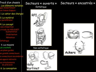 Tracé d’un chassis
ype d’édentement
Les crochets
L’axe d’insertion
Les plans guides
a triade de HOUSSET
Les tissus d’appuis
Sustentation
Stabilisation
Rétention
Esthétique
es grands connecteurs
es connecteurs secondaires
Le paralléliseur
. Les éléments notables
3. Le matériel
4. Le concept
5. Les moyens
Les appuis indirects
6. La conception
2. Le cahier des charges
Les attachements
de précision
Secteurs « ouverts » Secteurs « encastrés »
RPI
Nally
Martinet
Ackers
Esthétique
Non esthétique
 