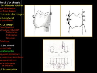 Tracé d’un chassis
ype d’édentement
Les crochets
L’axe d’insertion
Les plans guides
a triade de HOUSSET
Les tissus d’appuis
Sustentation
Stabilisation
Rétention
Esthétique
es grands connecteurs
es connecteurs secondaires
Le paralléliseur
. Les éléments notables
3. Le matériel
4. Le concept
5. Les moyens
Les appuis indirects
6. La conception
2. Le cahier des charges
Les attachements
de précision
 