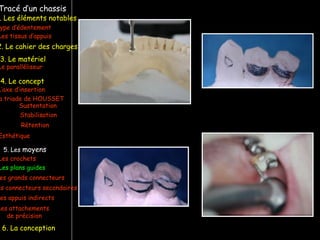 Tracé d’un chassis
ype d’édentement
Les crochets
L’axe d’insertion
Les plans guides
a triade de HOUSSET
Les tissus d’appuis
Sustentation
Stabilisation
Rétention
Esthétique
es grands connecteurs
es connecteurs secondaires
Le paralléliseur
. Les éléments notables
3. Le matériel
4. Le concept
5. Les moyens
Les appuis indirects
6. La conception
2. Le cahier des charges
Les attachements
de précision
 