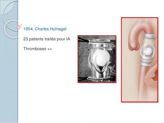 Pourquoi la veine sur les pieds tire