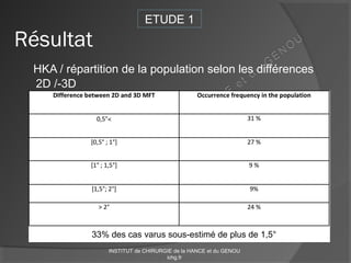 HKA / répartition de la population selon les différences
2D /-3D
Résultat
ETUDE 1
33% des cas varus sous-estimé de plus de 1,5°
INSTITUT de CHIRURGIE de la HANCE et du GENOU
ichg.fr
 