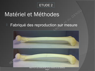 Matériel et Méthodes
 Fabriqué des reproduction sur mesure
ETUDE 2
INSTITUT de CHIRURGIE de la HANCE et du GENOU
ichg.fr
 