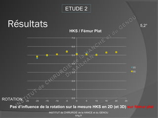 ROTATION
ETUDE 2
Résultats
Pas d’influence de la rotation sur la mesure HKS en 2D (et 3D) sur fémur plat
5,2°
INSTITUT de CHIRURGIE de la HANCE et du GENOU
ichg.fr
 