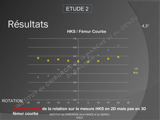 ROTATION
ETUDE 2
Résultats
Influence nette de la rotation sur la mesure HKS en 2D mais pas en 3D
fémur courbe
4,3°
INSTITUT de CHIRURGIE de la HANCE et du GENOU
ichg.fr
 
