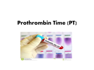 Prothrombin Time (PT)
 