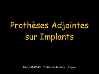 Prothèses Adjointes sur Implants Robert GRATUZE  Prothésiste Dentaire  Avignon  