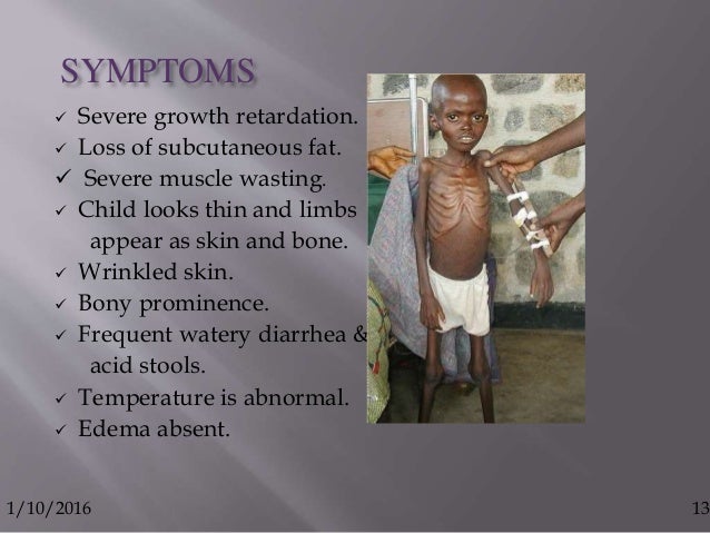 Protien calorie malnutrition &amp; starvation