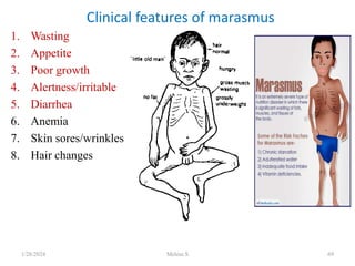 1. Wasting
2. Appetite
3. Poor growth
4. Alertness/irritable
5. Diarrhea
6. Anemia
7. Skin sores/wrinkles
8. Hair changes
Clinical features of marasmus
1/28/2024 Melese.S 69
 