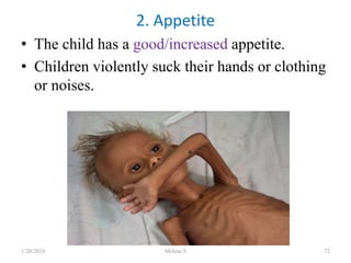 • The child has a good/increased appetite.
• Children violently suck their hands or clothing
or noises.
2. Appetite
1/28/2024 Melese.S 72
 