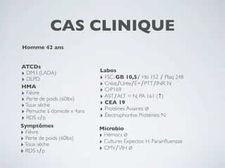 CAS CLINIQUE
Homme 42 ans


ATCDs:
                               Labos
‣ DM I (LADA)
‣ DLPD                         ‣ FSC: GB 10,5∕ Hb 152 ∕ Plaq 248
HMA                            ‣ Créat∕Urée∕É+∕PTT∕INR: N
‣ Fièvre                       ‣ CrP169
‣ Perte de poids (60lbs)       ‣ AST∕ALT = N; PA 161 (↑)
‣ Toux sèche                   ‣ CEA 19
‣ Perruche à domicile x 4ans   ‣ Protéines Aviaires: ∅
‣ RDS s∕p                      ‣ Électrophorèse Protéines: N
Symptômes                      Microbio
‣ Fièvre                       ‣ Hémocs ∅
‣ Perte de poids (60lbs)       ‣ Cultures Expectos: H. Parainﬂuenzae
‣ Toux sèche
‣ RDS s∕p                      ‣ CMV∕VIH ∅
 