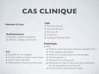 CAS CLINIQUE
Homme 42 ans                            LBA:
                                        ‣ Pneumocystis: ∅
                                        ‣ Mycobactéries: ∅
                                        ‣ Mycoses: ∅
RxPulmonaire:                           ‣ Culture: ∅
‣ Multiples opacités alvéolaires        ‣ Cytologie: Matériel Bénin
‣ Diffuses, 2 plages pulmonaires
                                         Pathologie:
                                         ‣ BTB:
                                           ‣ Matériel protéinacé éosinophilique alvéolaire PAS +
CT:                                        ‣ ↑Macrophages alvéolaires
‣ Opacités en verre dépoli                 ‣ Présence de silicate dans ces macrophages
‣ 2 lobes inférieurs, lobe moyen, lingula ‣ Cellules géantes +
‣ Patron ‘‘Pierre de Pavé’’                ‣ Muqueuse bronchique s∕p
‣ Adénopathies hilaires symmétriques ‣ Épaisissement léger et focal des septa alvéolaires
                                             ‣ 2nd hyperplasie pneumocyte II
                                           ‣ Discret inﬁltrat inﬂammatoire septal
 